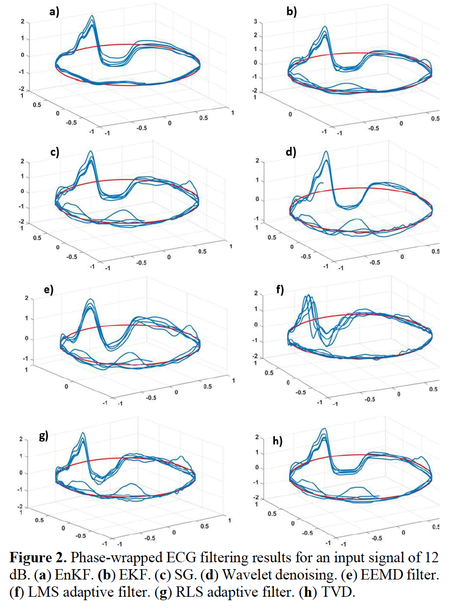 ECG Denoising with EnKF (EMBC 2022)